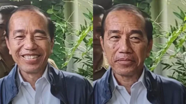 Penyakit Kulit Jokowi Jadi Sorotan
