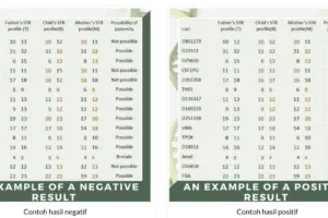 Hasil Tes DNA Ridwan Kamil – Lisa Mariana